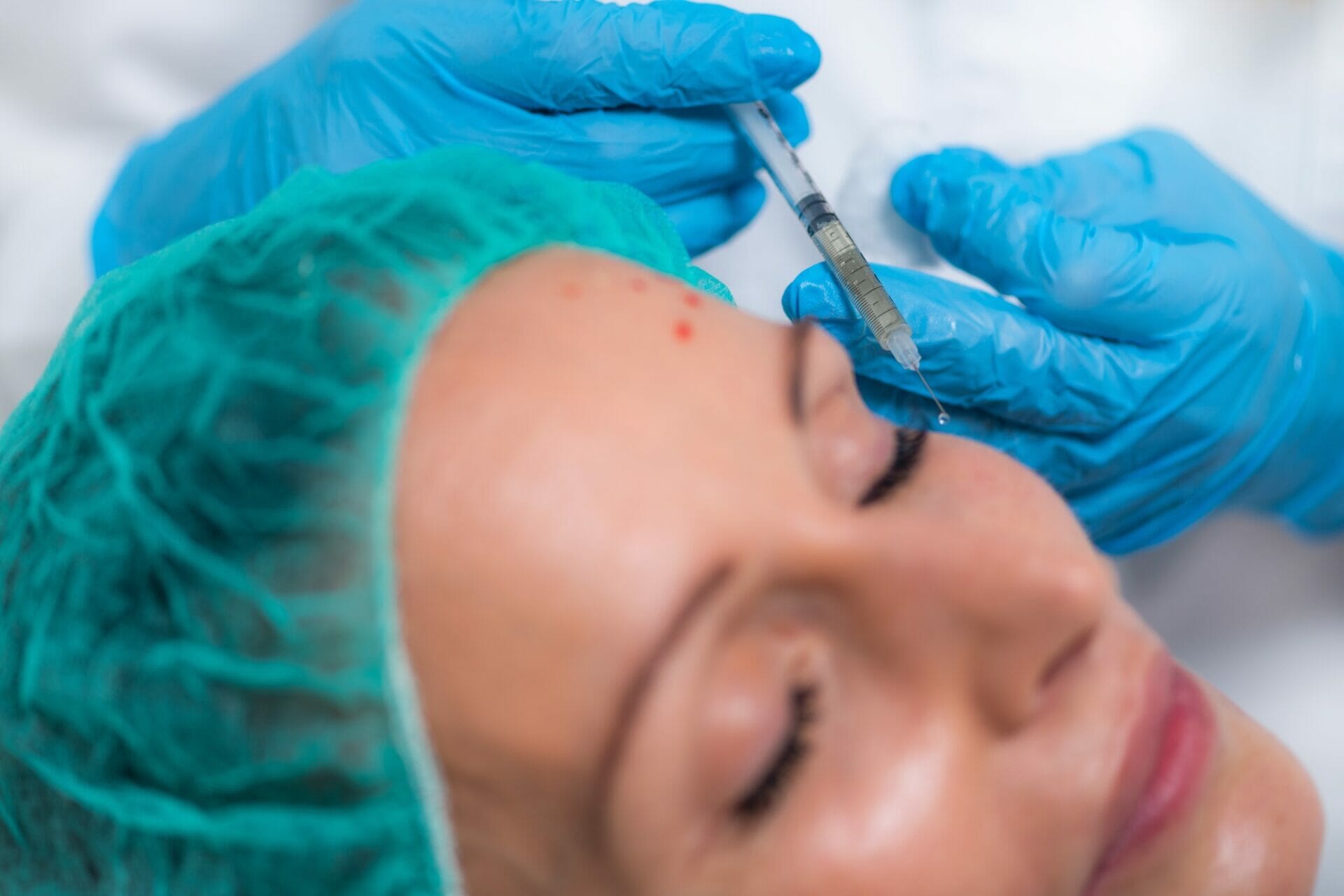 PRP or Platelet Rich Plasma Cosmetic Face Treatment